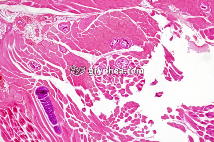 Sarcocystis dans muscle x10 - gryphea.org